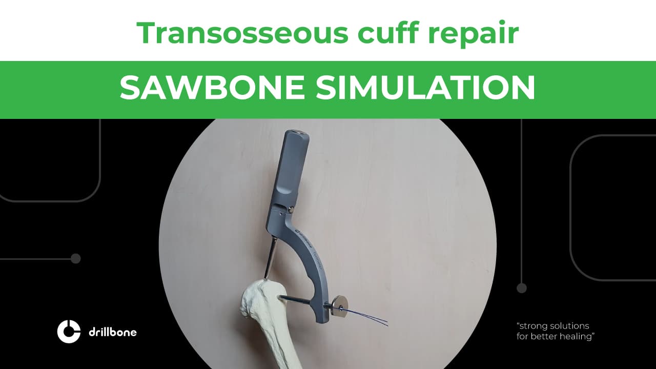SAWBONE SIMULATION
