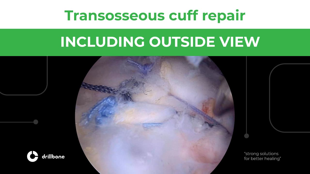 including outside view