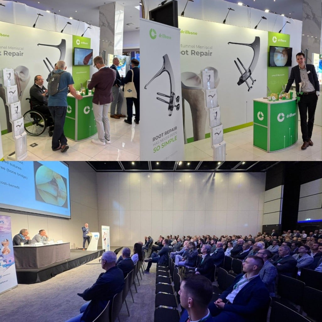 Drillbone na XXVIII. Národním kongresu ČSOT v Praze